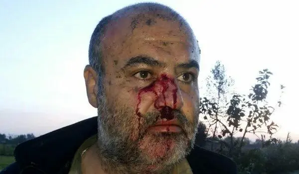 مجروحیت یک محیط‌بان در درگیری با شکارچیان +عکس