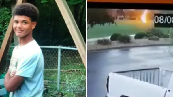 
اصابت صاعقه پسر نوجوان را به کما فرستاد! + عکس
