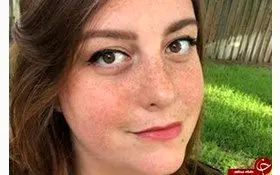 سوسکی 9 روز در گوش زنی جا خوش کرد + عکس