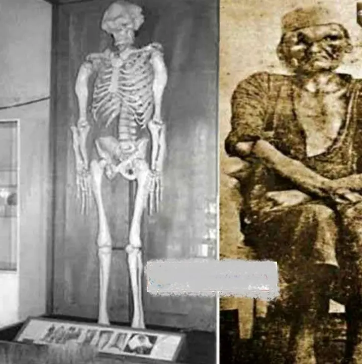 مردی با اسکلت بندی غیرمعمولی در تاریخ ایران+عکس