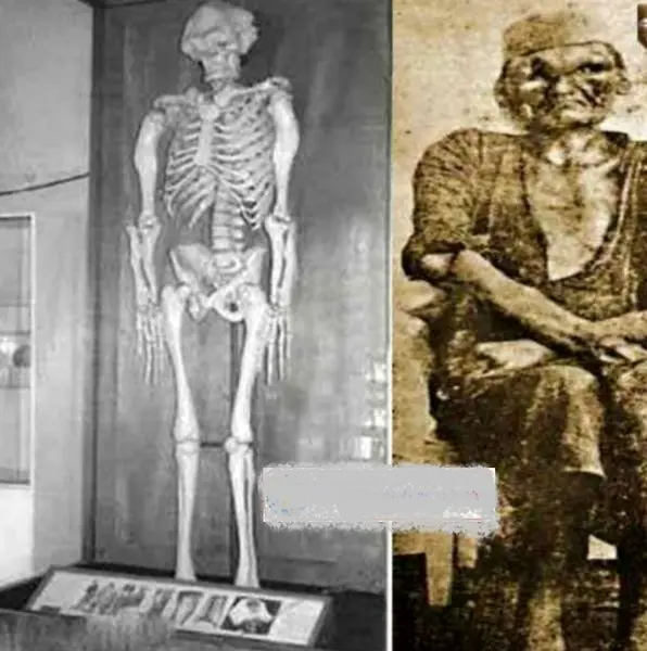 مردی با اسکلت بندی غیرمعمولی در تاریخ ایران+عکس