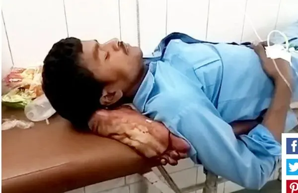 اتفاقی وحشتناک در یک بیمارستان/استفاده از پای قطع شده به جای بالش+عکس