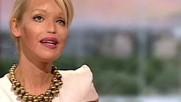 خانم مجری مشهور و زیبا قربانی اسید پاشی!+عکس