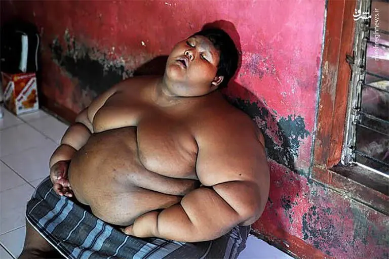 چاق‌ترین کودک جهان پس از لاغری! + عکس