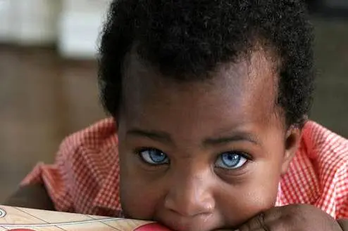 پسر بچه‌ای با چشمانی عجیب و جادویی+عکس