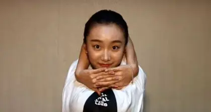 دختری که به خاطر وضعیت جسمانی غیرعادیاش مشهور شد + عکس