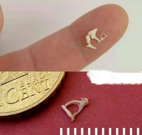 کوچکترین استخوان بدن انسان+عکس