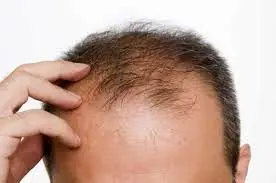 بایدها و نبایدهای خوراکی برای حفظ سلامت موهایتان
