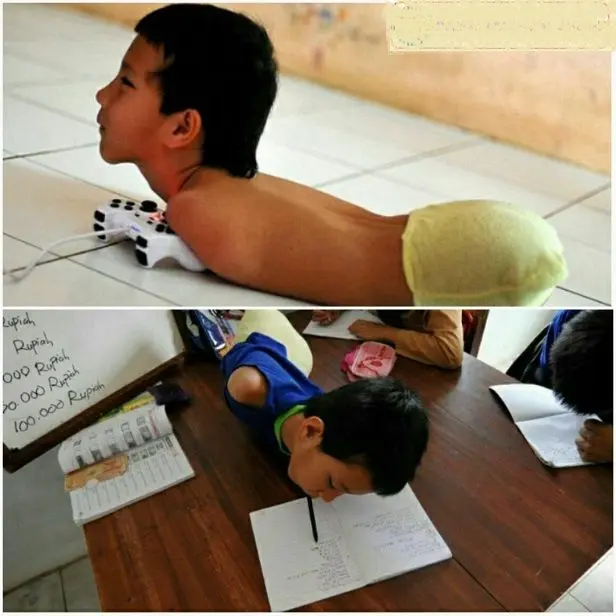 دانش آموز معلولی که دست و پا ندارد+عکس