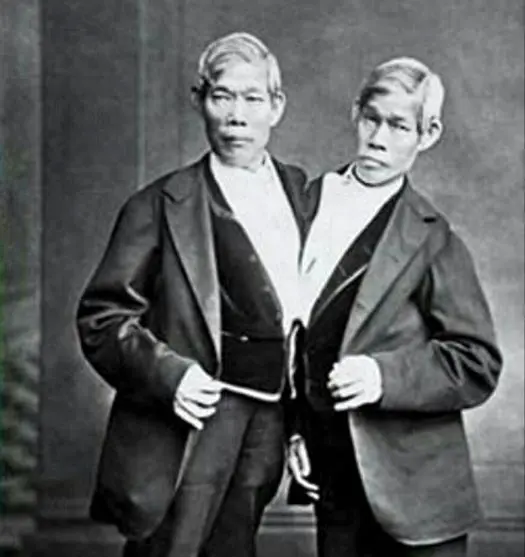 دوقلو های به هم چسبیده آمریکایی+عکس