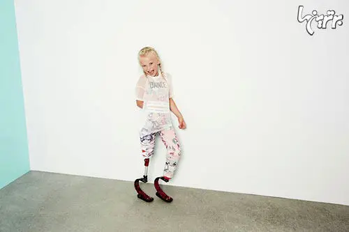 
مدل ۸ ساله‌ای که پا ندارد! + عکس