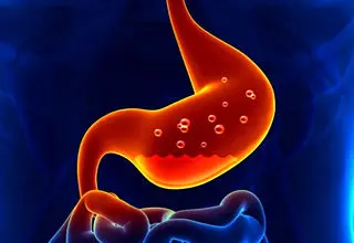 درمان سوزش معده در دوران بارداری

