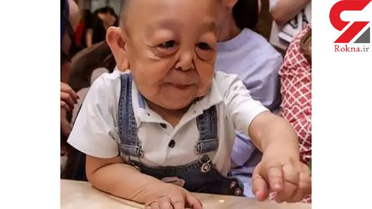 پیرمردی که فقط 6 سال دارد! + تصاویر 
