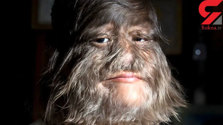 زشت‌ترین دختر دنیا در گینس چگونه زیبا شد ؟! + عکس‌