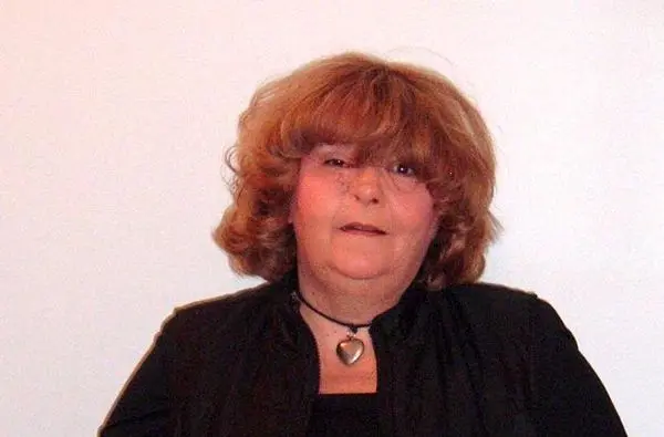 زندگی عجیب زنی که مجبور است با چشمانش نفس بکشد+عکس