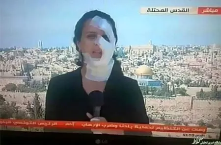 چهره عجیب خبرنگار زن در پخش زنده اخبار +عکس
