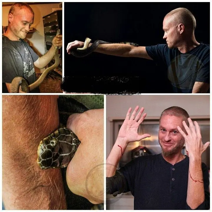 مردی که یک مار 160 بار او را نیش زد+عکس