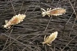 
روش عجیب مرد جوان برای خلاص شدن از شپش! + عکس