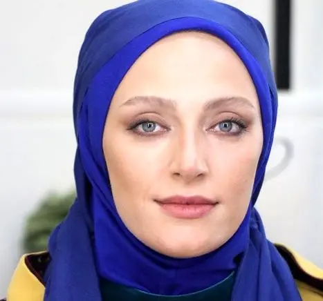 بازیگر زن تلویزیون با بینی عمل شده+عکس
