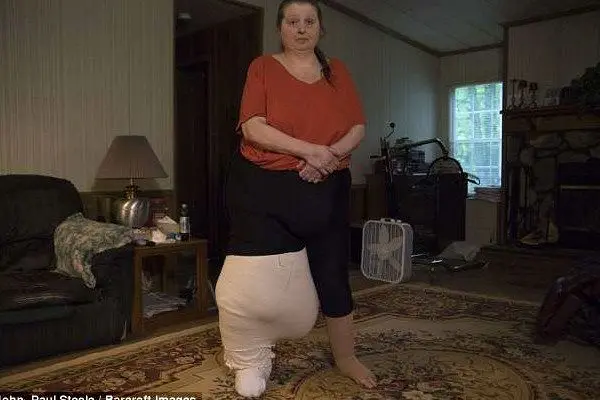 بزرگ‌ترین پای دنیا + عکس 