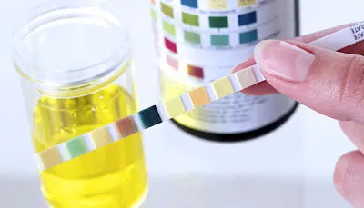 شایعترین علت تغییر رنگ ادرار چیست؟