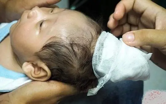 تولد نوزادی شاخدار+عکس