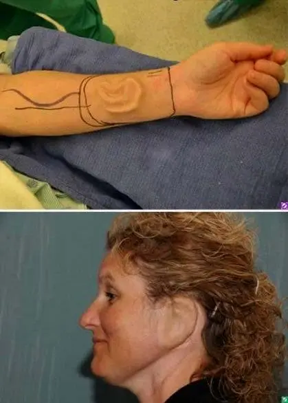 زنی که گوش هایش روی دستش است!+عکس