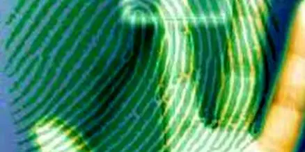 زنی که اثر انگشت نداشت + تصاویر