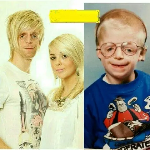 زشت ترین پسر دنیا مدل شد!+عکس