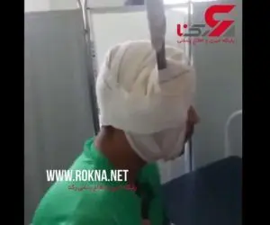 فرو رفتن چاقوی بزرگ در سر مرد خونسرد! + عکس