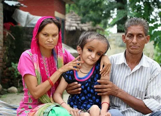  یک دختر سری به اندازه یک هندوانه دارد ! + عکس 