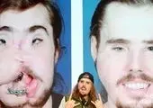 30 عمل جراحی برای شبیه شدن به کره ای ها ! + عکس