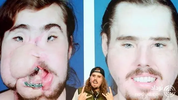 بلایی که این مرد بر صورت خودش آورد!+عکس
