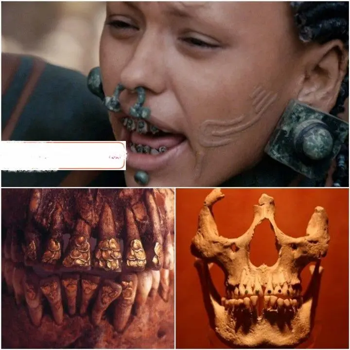 قبیله ای که مبتکر کاشت دندان بود+عکس