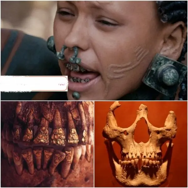 قبیله ای که مبتکر کاشت دندان بود+عکس