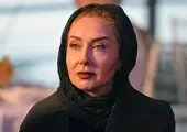 تغییر چهره عجیب آقای بازیگر + عکس