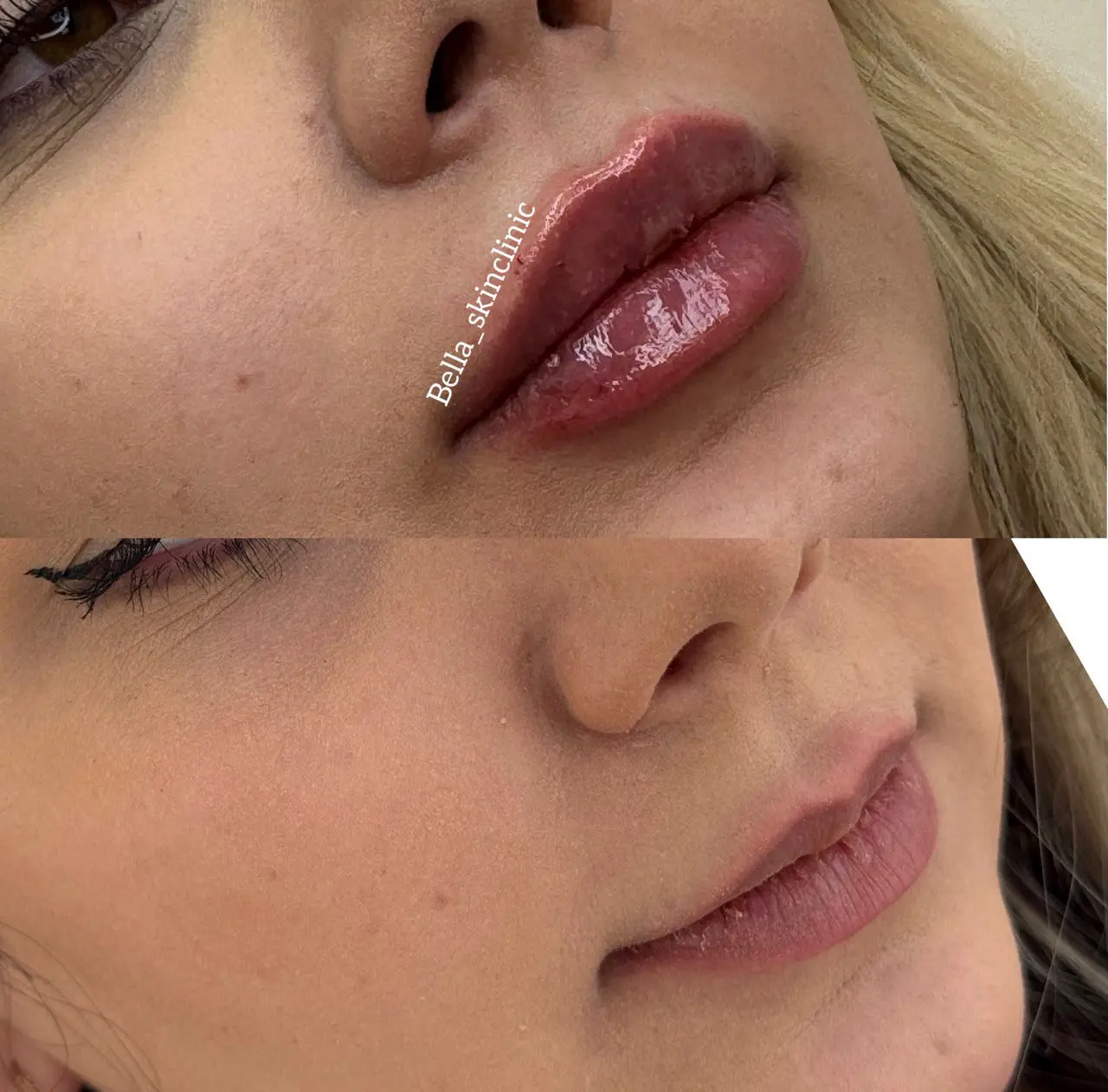 ژل لب روسی چیست و برای چه لب‌هایی مناسب است؟