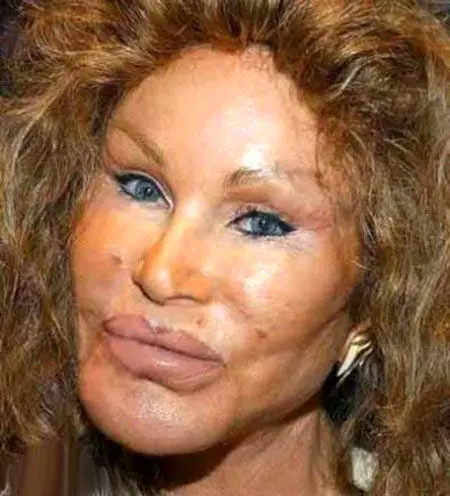 این زن رکوردار بیشتری عمل جراحی است!+عکس