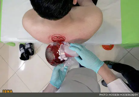 حجامت در بهار؛ آری یا خیر؟