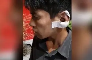 ماجرای بریدن گوش کودک کار صحنه سازی بود