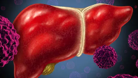 هپاتیت در چه افرادی باعث مرگ میشود؟