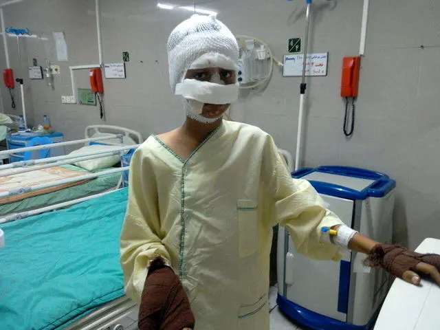 5 کودک قزوینی با مواد محترقه
سوختند
