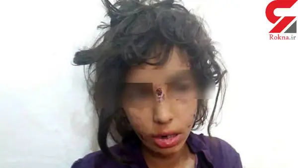 آزادی پدر و نامادری کودک آزار ماهشهری با فیش حقوقی ! + عکس