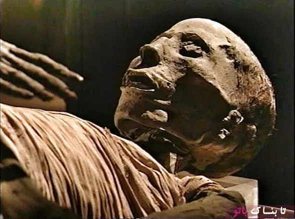 فراعنه پیشگامان جراحی مفصل در جهان + تصاویر