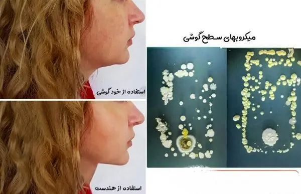 میکروب های صفحه موبایل روی پوست شما+عکس