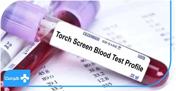 اهمیت انجام آزمایش TORCH در بارداری!