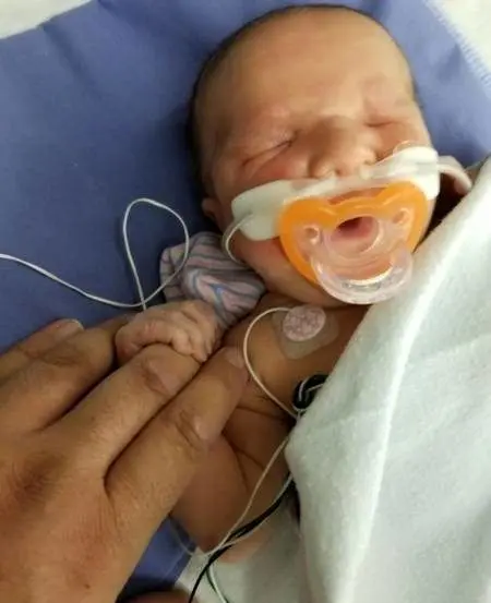 تولد یک نوزاد عجیب و بدون چشم+عکس