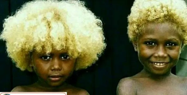 ژن کمیاب مردمانی با پوست سیاه +عکس