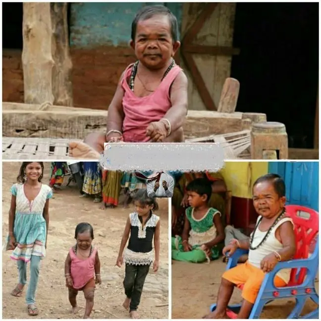  مرد 50 ساله ای که از 5 سالگی رشد نکرد+عکس