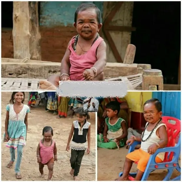  مرد 50 ساله ای که از 5 سالگی رشد نکرد+عکس